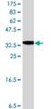 UDP-Glucose Ceramide Glucosyltransferase antibody, H00007357-A01, Novus Biologicals, Western Blot image 