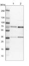 Papillary thyroid carcinoma-encoded protein antibody, NBP1-85351, Novus Biologicals, Western Blot image 