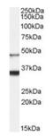 Hypocretin Receptor 1 antibody, orb125006, Biorbyt, Western Blot image 