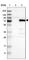 Vezatin, Adherens Junctions Transmembrane Protein antibody, HPA017066, Atlas Antibodies, Western Blot image 