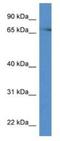 Protein Kinase C Eta antibody, NBP1-74117, Novus Biologicals, Western Blot image 
