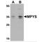 Transmembrane Protein 173 antibody, MBS150515, MyBioSource, Western Blot image 