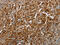 Programmed Cell Death 2 antibody, CSB-PA116985, Cusabio, Immunohistochemistry paraffin image 