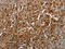 Programmed cell death protein 2 antibody, CSB-PA116985, Cusabio, Immunohistochemistry paraffin image 