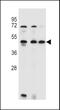 Ankyrin Repeat Domain 40 antibody, LS-C156351, Lifespan Biosciences, Western Blot image 