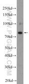 Epithelial Splicing Regulatory Protein 2 antibody, 23117-1-AP, Proteintech Group, Western Blot image 