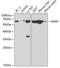 Macrophage Scavenger Receptor 1 antibody, A1923, ABclonal Technology, Western Blot image 