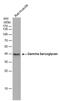 Sarcoglycan Gamma antibody, PA5-78453, Invitrogen Antibodies, Western Blot image 