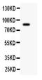 Gelsolin antibody, LS-C344063, Lifespan Biosciences, Western Blot image 