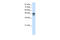 RNA Binding Motif Single Stranded Interacting Protein 3 antibody, 29-227, ProSci, Enzyme Linked Immunosorbent Assay image 