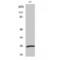 Ubiquitin C-Terminal Hydrolase L1 antibody, LS-C386617, Lifespan Biosciences, Western Blot image 