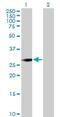 Small Nuclear Ribonucleoprotein Polypeptide N antibody, H00006638-B01P, Novus Biologicals, Western Blot image 