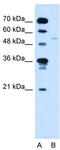 Retinoic acid receptor RXR-gamma antibody, TA343644, Origene, Western Blot image 