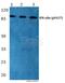 Interferon Gamma Receptor 1 antibody, A01716Y457, Boster Biological Technology, Western Blot image 