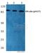 Interferon Gamma Receptor 1 antibody, A01716Y457, Boster Biological Technology, Western Blot image 