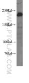 Myosin Heavy Chain 9 antibody, 60233-1-Ig, Proteintech Group, Western Blot image 