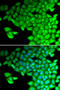 Myosin Light Chain 2 antibody, STJ27426, St John