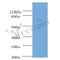 Escherichia coli ATP-dependent DNA helicase RecQ  antibody, LS-C318712, Lifespan Biosciences, Western Blot image 