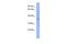 Vesicle Trafficking 1 antibody, PA5-44649, Invitrogen Antibodies, Western Blot image 