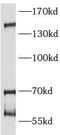 ATPase Family AAA Domain Containing 5 antibody, FNab00656, FineTest, Western Blot image 