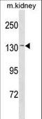 Calcium Sensing Receptor antibody, LS-C157602, Lifespan Biosciences, Western Blot image 