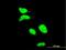 Apoptosis Antagonizing Transcription Factor antibody, H00026574-M09, Novus Biologicals, Immunocytochemistry image 