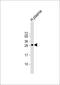 Complement C1q B Chain antibody, A04233-2, Boster Biological Technology, Western Blot image 