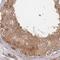 Proteasome 26S Subunit, Non-ATPase 9 antibody, NBP2-47560, Novus Biologicals, Immunohistochemistry paraffin image 