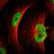 Metastasis Associated 1 antibody, HPA005544, Atlas Antibodies, Immunofluorescence image 