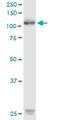 Tyrosine-protein kinase transmembrane receptor ROR1 antibody, H00004919-M02, Novus Biologicals, Western Blot image 