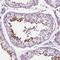 Pentraxin 3 antibody, NBP2-49595, Novus Biologicals, Immunohistochemistry paraffin image 