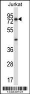 Mucolipin 1 antibody, 57-113, ProSci, Western Blot image 
