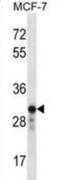 GRB2 Related Adaptor Protein 2 antibody, abx028269, Abbexa, Western Blot image 