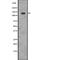 Eukaryotic Translation Initiation Factor 2 Alpha Kinase 3 antibody, abx215103, Abbexa, Western Blot image 