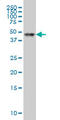 Retinoic Acid Receptor Alpha antibody, LS-B5525, Lifespan Biosciences, Western Blot image 