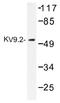 Potassium Voltage-Gated Channel Modifier Subfamily S Member 2 antibody, AP01495PU-N, Origene, Western Blot image 