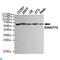 Switching B Cell Complex Subunit SWAP70 antibody, LS-C813128, Lifespan Biosciences, Western Blot image 