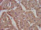 Oligophrenin-4 antibody, CSB-PA011624LA01HU, Cusabio, Immunohistochemistry paraffin image 