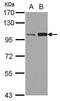 Kinesin Family Member 3C antibody, GTX112629, GeneTex, Western Blot image 