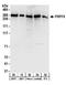 Pre-mRNA-processing-splicing factor 8 antibody, A303-920A, Bethyl Labs, Western Blot image 