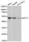 Keratin 17 antibody, abx001787, Abbexa, Western Blot image 