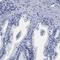 Apolipoprotein B MRNA Editing Enzyme Catalytic Subunit 2 antibody, HPA017957, Atlas Antibodies, Immunohistochemistry paraffin image 