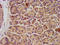 Potassium Two Pore Domain Channel Subfamily K Member 3 antibody, LS-C671562, Lifespan Biosciences, Immunohistochemistry paraffin image 
