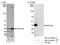 Protein Phosphatase 1 Catalytic Subunit Beta antibody, NB110-40550, Novus Biologicals, Western Blot image 