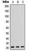 Ras Homolog Family Member A antibody, LS-C368499, Lifespan Biosciences, Western Blot image 