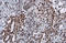 RAD50 Double Strand Break Repair Protein antibody, GTX70228, GeneTex, Immunohistochemistry paraffin image 