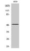 Histone methyltransferase SMYD2 antibody, A04281, Boster Biological Technology, Western Blot image 