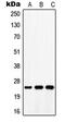 Distal Membrane Arm Assembly Complex 2 Like antibody, MBS820678, MyBioSource, Western Blot image 