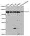 Histone Deacetylase 4 antibody, abx000624, Abbexa, Western Blot image 