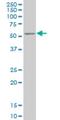 Zinc Finger Protein 213 antibody, H00007760-M03, Novus Biologicals, Western Blot image 